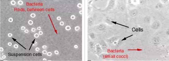 细菌污染的细胞图片